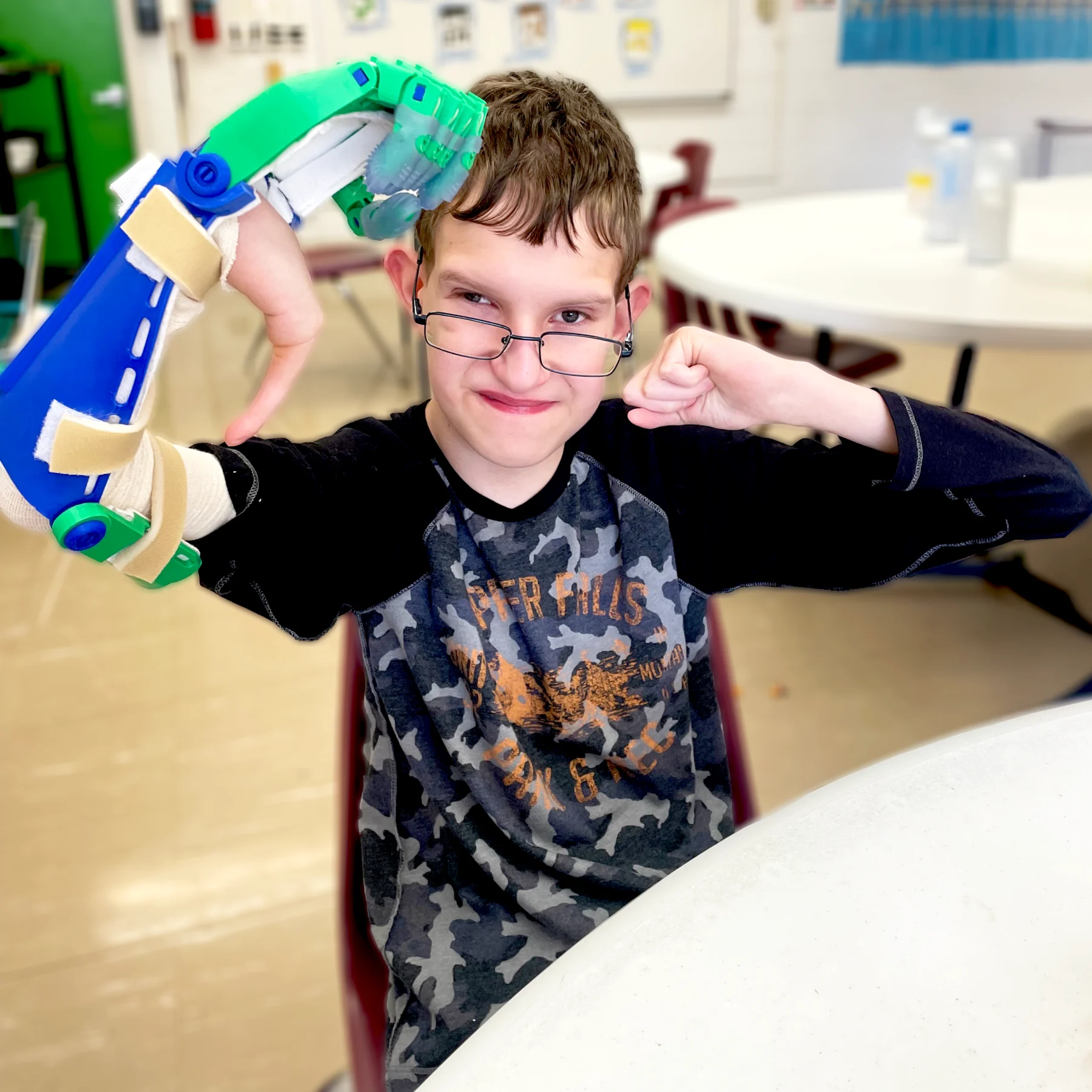 Young boy using non medical prosthetic