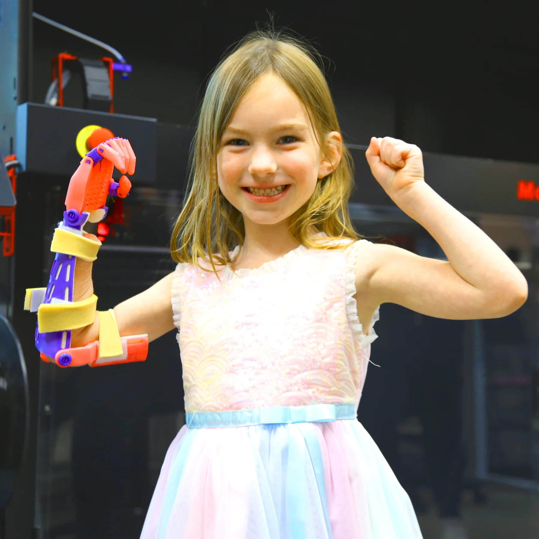 Young girl using upper arm prosthetic
